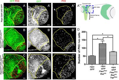 Tep1 Regulates Yki Activity in Neural Stem Cells in Drosophila Glioma Model